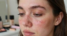 incorrect application causes irritation